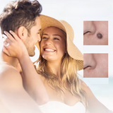 Carvallo – Naturlig vårtorpsavlägsnare Carvallo