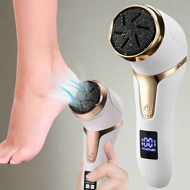 Royaleva Vacuum Callus Remover med uppladdningsbart batteri Carvallo