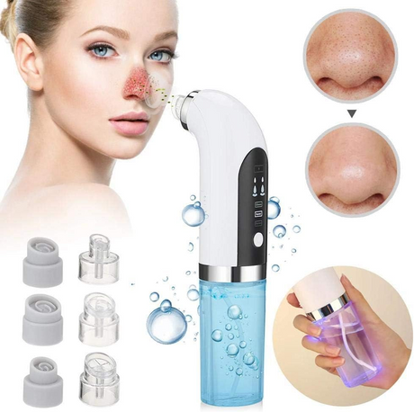 Uppdaterad Blackhead Remover Pore Vacuum Carvallo