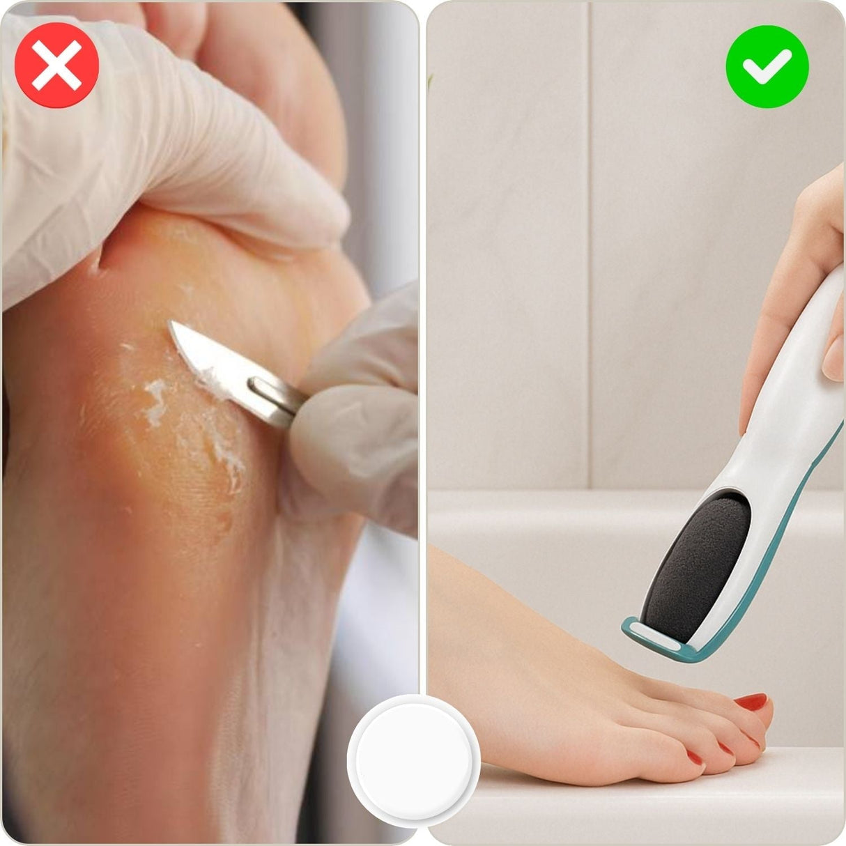 SilkyStep – Uppladdningsbar elektrisk fotfil | Vattentät förhårdnaderborttagare och pedikyrverktyg MILA Sverige