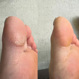 Elektrisk Fotfil - få lena och fina fötter-Hemnix-Hemnix