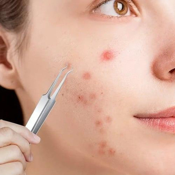 Luxora Svartprick Tång - Anti Svartprick Kit Set 3 Pcs Carvallo