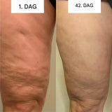 GlowCup – Cellulite Remover och Hudåtstramning med Rödljus och Koppningsterapi-Electric Massagers-BB-Hemnix