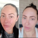 LED Ansiktsmask Ljusterapi Hudvårdsapparat Carvallo