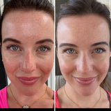 LED Ansiktsmask Ljusterapi Hudvårdsapparat Carvallo