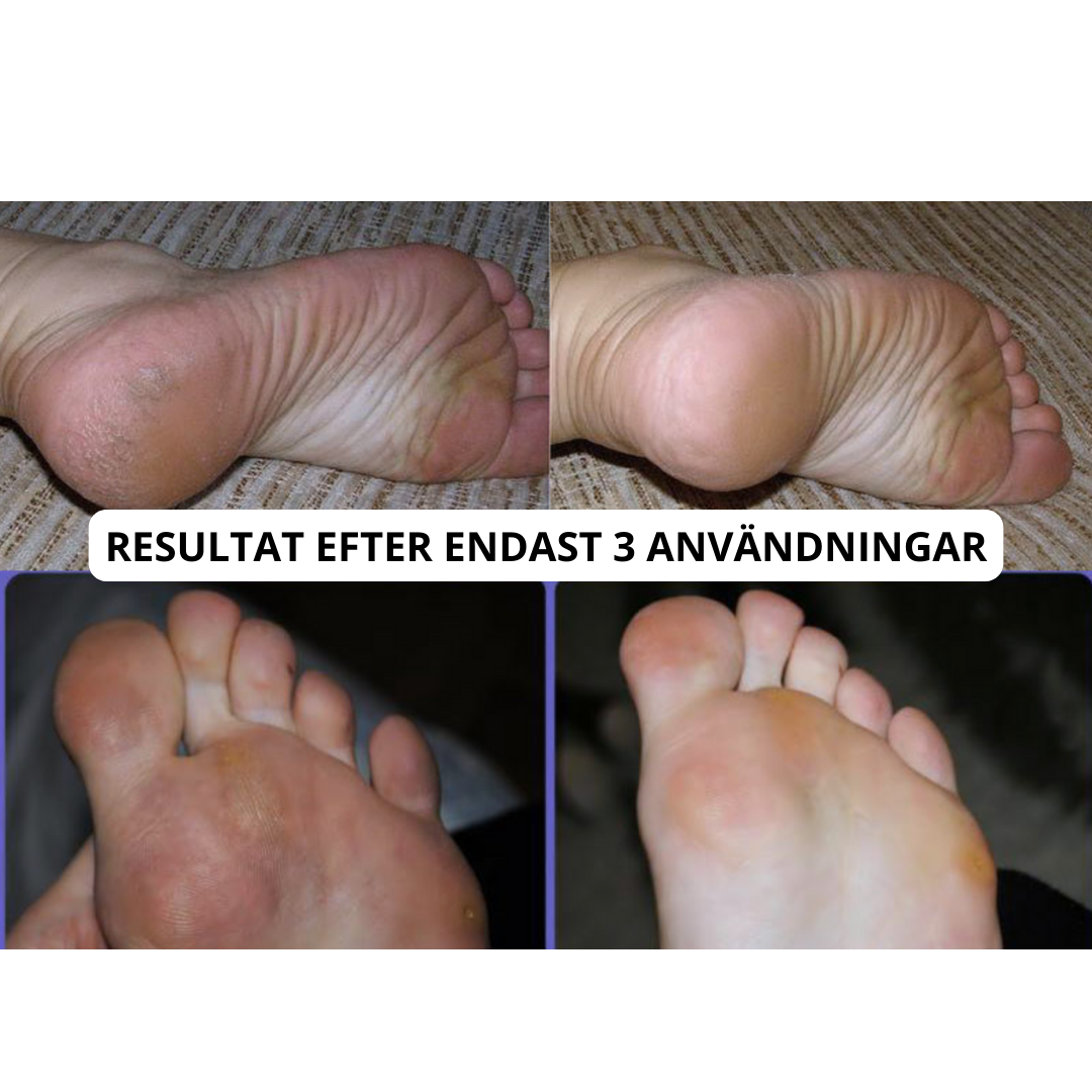 Elektrisk Fotfil Pro-VaruZ-Hemnix