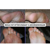 Elektrisk Fotfil Pro-VaruZ-Hemnix