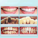 Carvallo tandrenser Plaktrino | tandsten- & belæg fjerner | blid & effektiv | kompakt 10 cm Carvallo