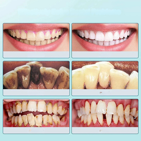 Carvallo tandrenser Plaktrino | tandsten- & belæg fjerner | blid & effektiv | kompakt 10 cm Carvallo