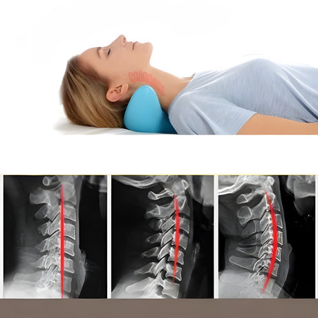 Nackstödskudde – Ergonomisk och Avslappnande | Perfekt mot spänningar Carvallo