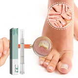 Carvallo | NailBloom – Säg farväl till spröda naglar för alltid Carvallo