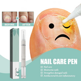 Carvallo | NailBloom – Säg farväl till spröda naglar för alltid Carvallo