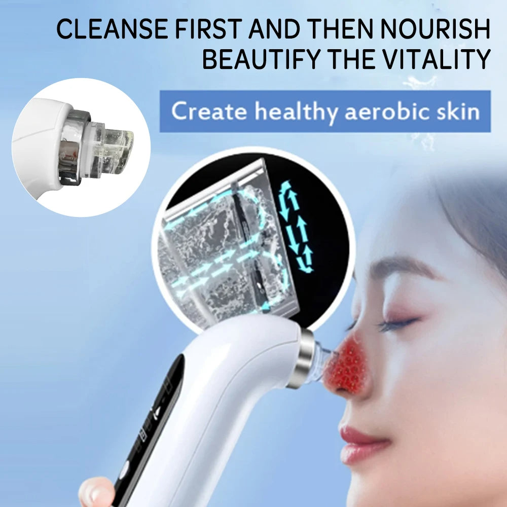 Uppdaterad Blackhead Remover Pore Vacuum Carvallo