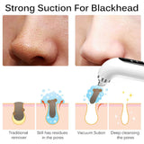 Uppdaterad Blackhead Remover Pore Vacuum Carvallo