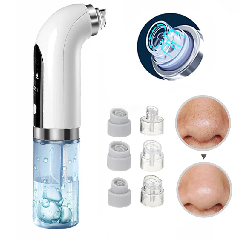 Uppdaterad Blackhead Remover Pore Vacuum Carvallo