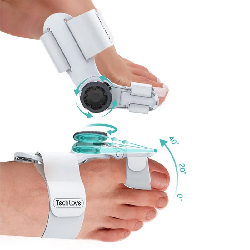 Uppgraderad Tå Bunion Korrigerare – Justerbar Ortopedisk Splint för Smärtlindring & Alignment Carvallo