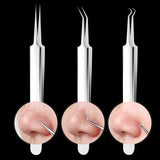 Luxora Svartprick Tång - Anti Svartprick Kit Set 3 Pcs Carvallo