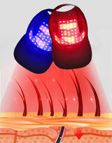 Röd ljus håråterväxtmössa – Infraröd hårbottenterapi för tjockare, fylligare hår MILA Sverige