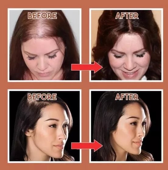 Royallure Natural Look Hår Toppklipp för Tunnande Hår Carvallo