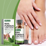 OnyFix – Nagelsvamp Behandling & Återställning av Nagelhälsa-Nail Care-BB-Hemnix