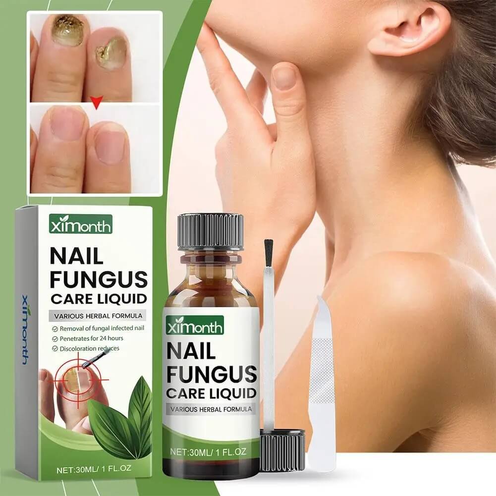 OnyFix – Nagelsvamp Behandling & Återställning av Nagelhälsa-Nail Care-BB-Hemnix