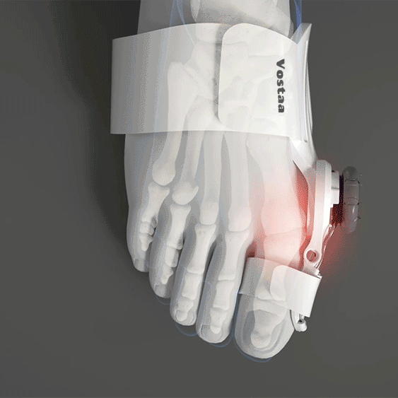 Carvallo - Hallux valgus-korrigerare Carvallo