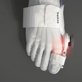 Carvallo - Hallux valgus-korrigerare Carvallo