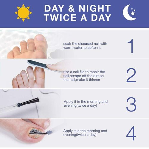 Avancerat svampdödande nagelserum – Snabb lindring av tånagel- och fingernagelinfektioner MILA Sverige