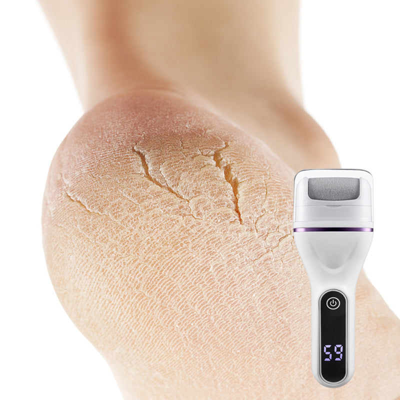 Carvallo Pro – För sammetsmjuka fötter på minuter Carvallo