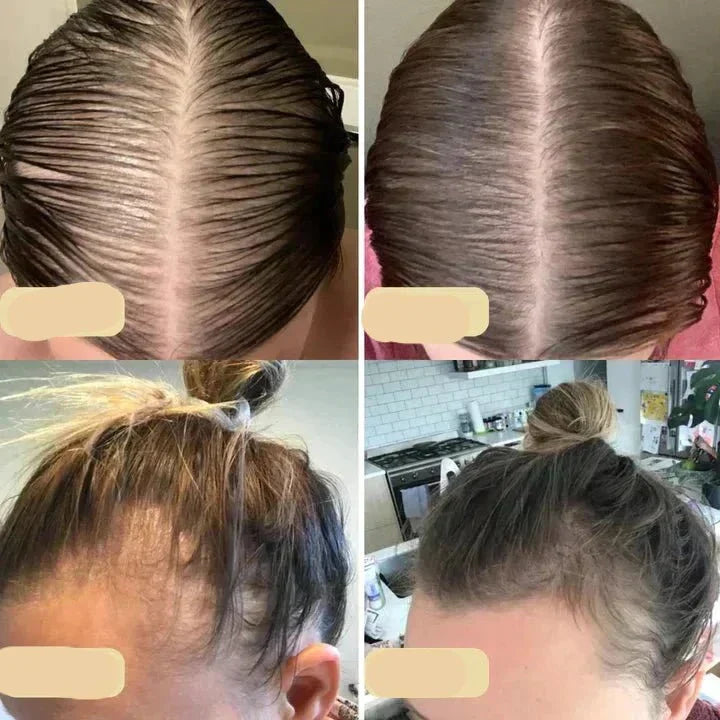 Veganskt hårväxtolja | Naturlig booster för sunt hårväxt Carvallo